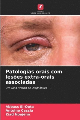 Patologias orais com leses extra-orais associadas 1