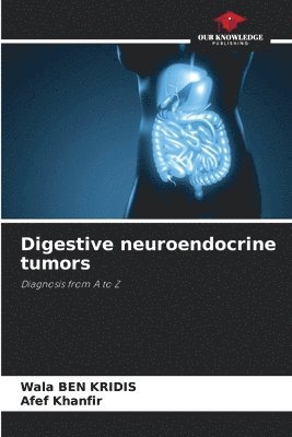 bokomslag Digestive neuroendocrine tumors