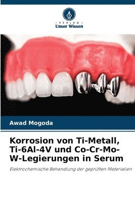 bokomslag Korrosion von Ti-Metall, Ti-6Al-4V und Co-Cr-Mo-W-Legierungen in Serum