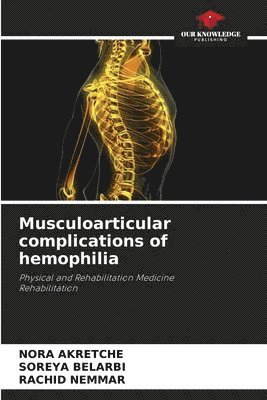 Musculoarticular complications of hemophilia 1