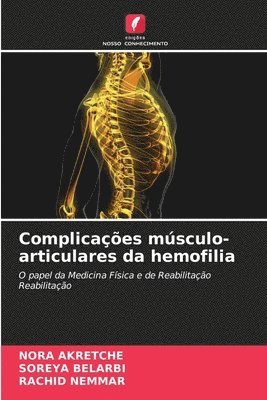 Complicaes msculo-articulares da hemofilia 1