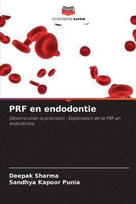 PRF en endodontie 1