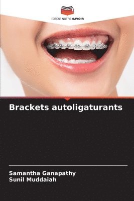 Brackets autoligaturants 1