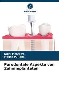 bokomslag Parodontale Aspekte von Zahnimplantaten