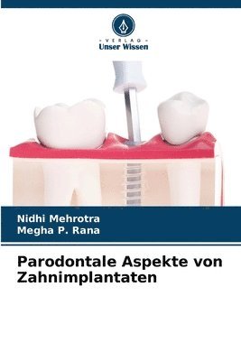 bokomslag Parodontale Aspekte von Zahnimplantaten