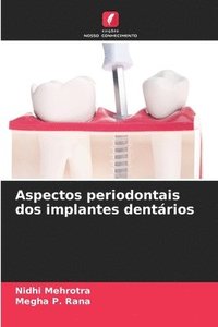 bokomslag Aspectos periodontais dos implantes dentrios