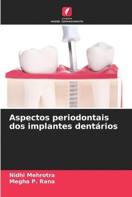 bokomslag Aspectos periodontais dos implantes dentrios