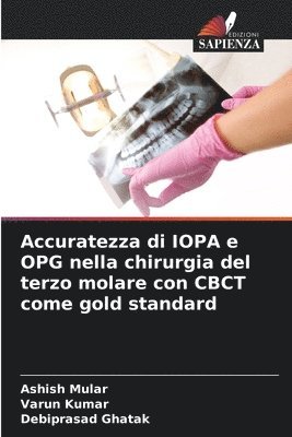 Accuratezza di IOPA e OPG nella chirurgia del terzo molare con CBCT come gold standard 1