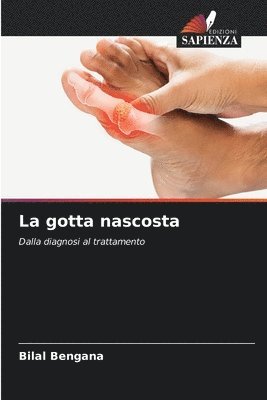 La gotta nascosta 1