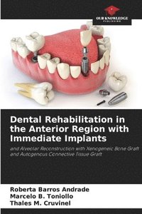 bokomslag Dental Rehabilitation in the Anterior Region with Immediate Implants