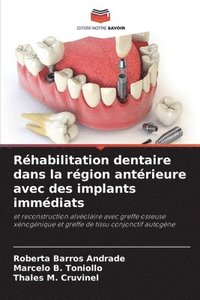 bokomslag Rhabilitation dentaire dans la rgion antrieure avec des implants immdiats