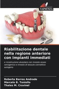 bokomslag Riabilitazione dentale nella regione anteriore con impianti immediati