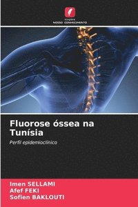 bokomslag Fluorose ssea na Tunsia