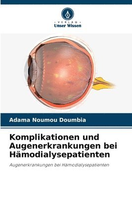 bokomslag Komplikationen und Augenerkrankungen bei Hmodialysepatienten