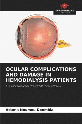 bokomslag Ocular Complications and Damage in Hemodialysis Patients