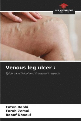 Venous leg ulcer 1