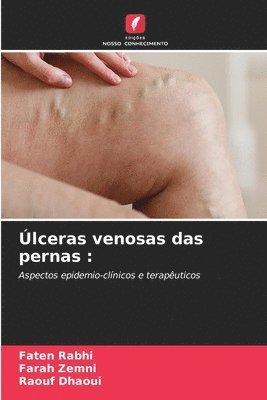 lceras venosas das pernas 1