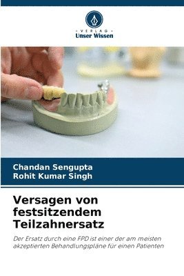 Versagen von festsitzendem Teilzahnersatz 1