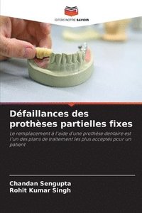 bokomslag Dfaillances des prothses partielles fixes