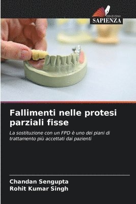 bokomslag Fallimenti nelle protesi parziali fisse