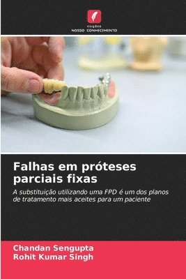 bokomslag Falhas em prteses parciais fixas