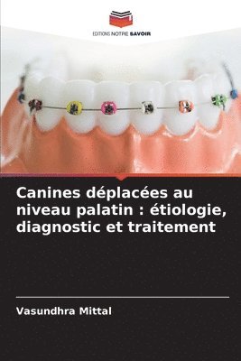 Canines dplaces au niveau palatin 1