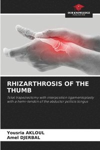 bokomslag Rhizarthrosis of the Thumb