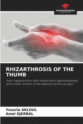 Rhizarthrosis of the Thumb 1