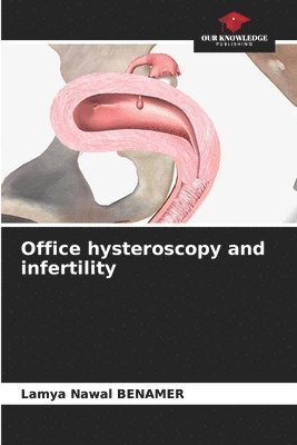 bokomslag Office hysteroscopy and infertility