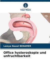 bokomslag Office hysteroskopie und unfruchtbarkeit