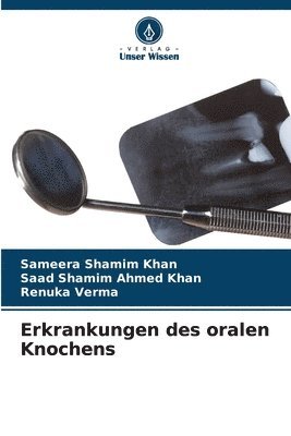 bokomslag Erkrankungen des oralen Knochens