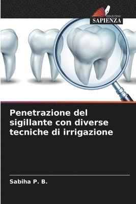 bokomslag Penetrazione del sigillante con diverse tecniche di irrigazione