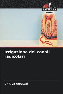 Irrigazione dei canali radicolari 1