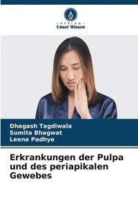 bokomslag Erkrankungen der Pulpa und des periapikalen Gewebes