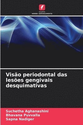 Viso periodontal das leses gengivais desquimativas 1