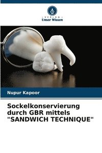 bokomslag Sockelkonservierung durch GBR mittels &quot;SANDWICH TECHNIQUE&quot;