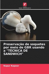 bokomslag Preservao de soquetes por meio de GBR usando a &quot;TCNICA DE SANDWICH&quot;