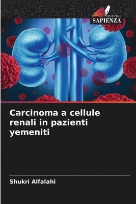 bokomslag Carcinoma a cellule renali in pazienti yemeniti