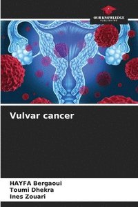 bokomslag Vulvar cancer