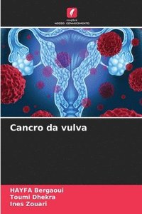 bokomslag Cancro da vulva