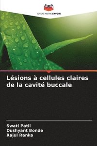 bokomslag Lsions  cellules claires de la cavit buccale