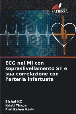 ECG nel MI con sopraslivellamento ST e sua correlazione con l'arteria infartuata 1