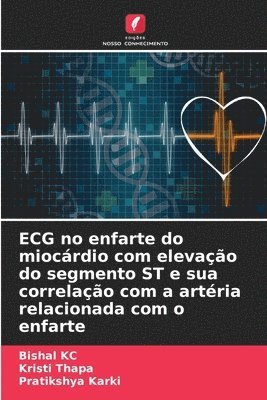 bokomslag ECG no enfarte do miocrdio com elevao do segmento ST e sua correlao com a artria relacionada com o enfarte