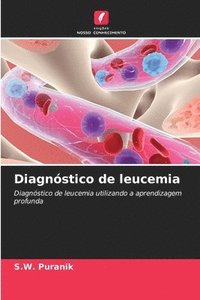 bokomslag Diagnstico de leucemia