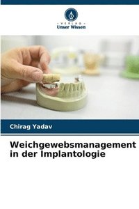 bokomslag Weichgewebsmanagement in der Implantologie