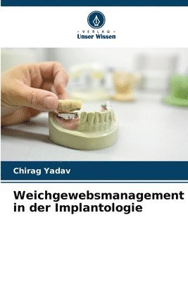 Weichgewebsmanagement in der Implantologie 1