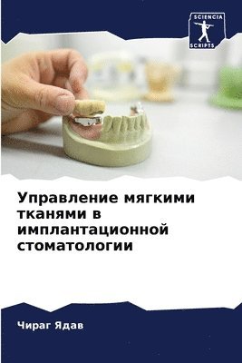 bokomslag &#1059;&#1087;&#1088;&#1072;&#1074;&#1083;&#1077;&#1085;&#1080;&#1077; &#1084;&#1103;&#1075;&#1082;&#1080;&#1084;&#1080; &#1090;&#1082;&#1072;&#1085;&#1103;&#1084;&#1080; &#1074;