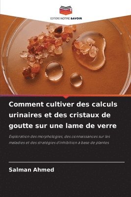 Comment cultiver des calculs urinaires et des cristaux de goutte sur une lame de verre 1