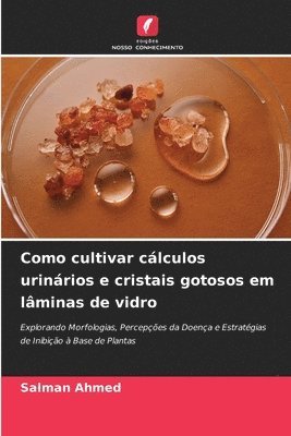 Como cultivar clculos urinrios e cristais gotosos em lminas de vidro 1