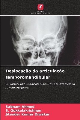 Deslocação da articulação temporomandibular